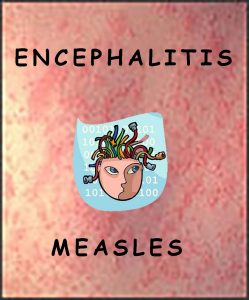 measles