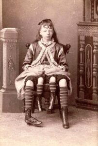 Myrtle Corbin micro wrestling exploitation of the disabled